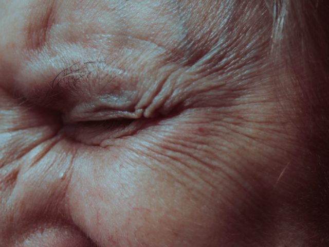 Il botulino: conosciamo la tossina più utilizzata in chirurgia e cosmesi